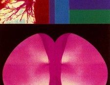 46263. Cillero, ������